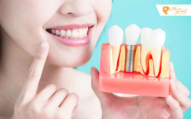 Những tác hại của trồng răng implant