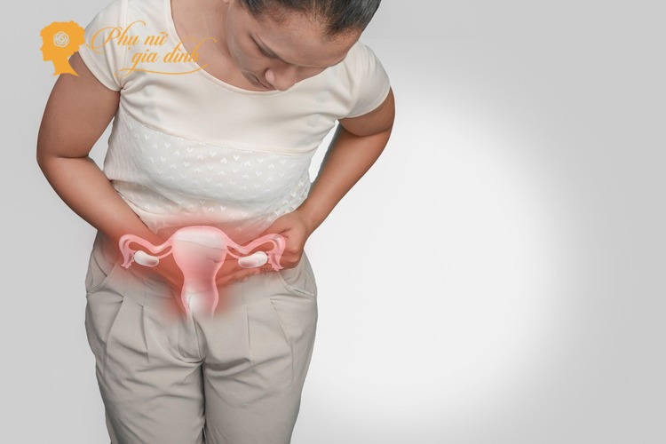 Viêm cổ tử cung có thể khiến bạn đau vùng xương chậu